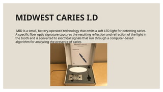 MIDWEST CARIES I.D
MID is a small, battery-operated technology that emits a soft LED light for detecting caries.
A specific fiber optic signature captures the resulting reflection and refraction of the light in
the tooth and is converted to electrical signals that run through a computer-based
algorithm for analyzing the presence of caries
 