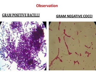 GRAM NEGATIVE COCCI
Observation
 