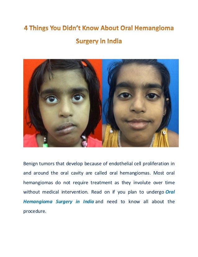 Benign tumors that develop because of endothelial cell proliferation in
and around the oral cavity are called oral hemangiomas. Most oral
hemangiomas do not require treatment as they involute over time
without medical intervention. Read on if you plan to undergo Oral
Hemangioma Surgery in India and need to know all about the
procedure.
 