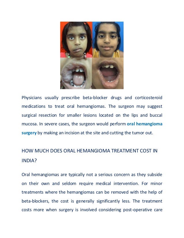 Physicians usually prescribe beta-blocker drugs and corticosteroid
medications to treat oral hemangiomas. The surgeon may suggest
surgical resection for smaller lesions located on the lips and buccal
mucosa. In severe cases, the surgeon would perform oral hemangioma
surgery by making an incision at the site and cutting the tumor out.
HOW MUCH DOES ORAL HEMANGIOMA TREATMENT COST IN
INDIA?
Oral hemangiomas are typically not a serious concern as they subside
on their own and seldom require medical intervention. For minor
treatments where the hemangiomas can be removed with the help of
beta-blockers, the cost is generally significantly less. The treatment
costs more when surgery is involved considering post-operative care
 