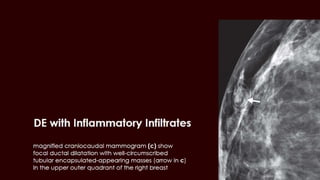 All thing breast ultrasound breast mammography part 1