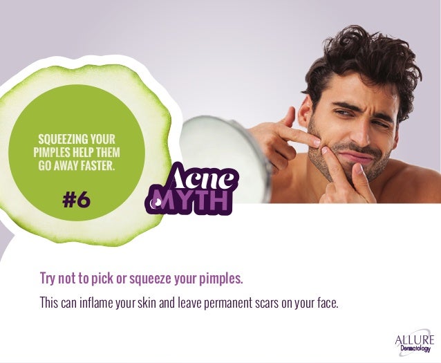 Top 10 Acne Myths By Allure Medical Spa