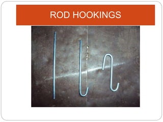 ROD HOOKINGS
 