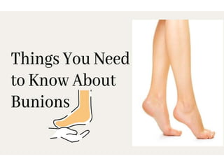 All You Need to Know About Bunions | PPTX