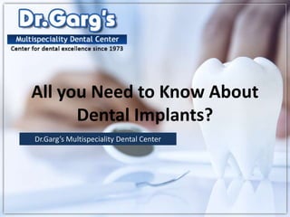 All you Need to Know About
Dental Implants?
Dr.Garg’s Multispeciality Dental Center
 