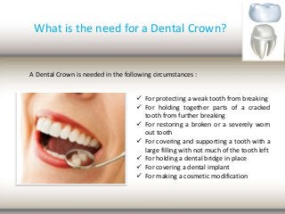 What is the need for a Dental Crown?
A Dental Crown is needed in the following circumstances :
 For protecting a weak tooth from breaking
 For holding together parts of a cracked
tooth from further breaking
 For restoring a broken or a severely worn
out tooth
 For covering and supporting a tooth with a
large filling with not much of the tooth left
 For holding a dental bridge in place
 For covering a dental implant
 For making a cosmetic modification
 