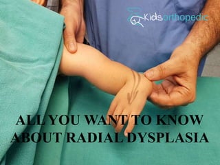 ALL YOU WANT TO KNOW
ABOUT RADIAL DYSPLASIA
 