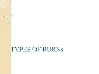 TYPES OF BURNs
 