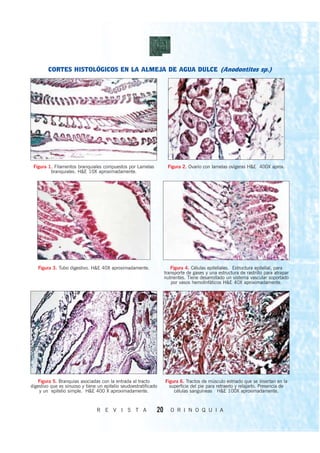 CORTES HISTOLÓGICOS EN LA ALMEJA DE AGUA DULCE (Anodontites sp.)




 Figura 1. Filamentos branquiales compuestos por Lamelas            Figura 2. Ovario con lamelas ovígeras H&E 400X aprox.
         branquiales. H&E 10X aproximadamente.




   Figura 3. Tubo digestivo. H&E 40X aproximadamente.                 Figura 4. Células epiteliales. Estructura epitelial, para
                                                                   transporte de gases y una estructura de rastrillo para atrapar
                                                                   nutrientes. Tiene desarrollado un sistema vascular soportado
                                                                      por vasos hemolinfáticos H&E 40X aproximadamente.




    Figura 5. Branquias asociadas con la entrada al tracto         Figura 6. Tractos de músculo estriado que se insertan en la
digestivo que es sinuoso y tiene un epitelio seudoestratificado      superficie del pie para retraerlo y relajarlo. Presencia de
    y un epitelio simple. H&E 400 X aproximadamente.                   células sanguíneas H&E 100X aproximadamente.


                                R E V I S T A                 20      O R I N O Q U I A
 