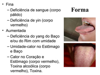 Forma
• Fina
– Deficiência de sangue (corpo
pálido)
– Deficiência de yin (corpo
vermelho)
• Aumentada
– Deficiência do yang do Baço
e/ou do Rim com umidade
– Umidade-calor no Estômago
e Baço
– Calor no Coração e
Estômago (corpo vermelho),
Toxina alcoólica (corpo
vermelho), Toxina.
 