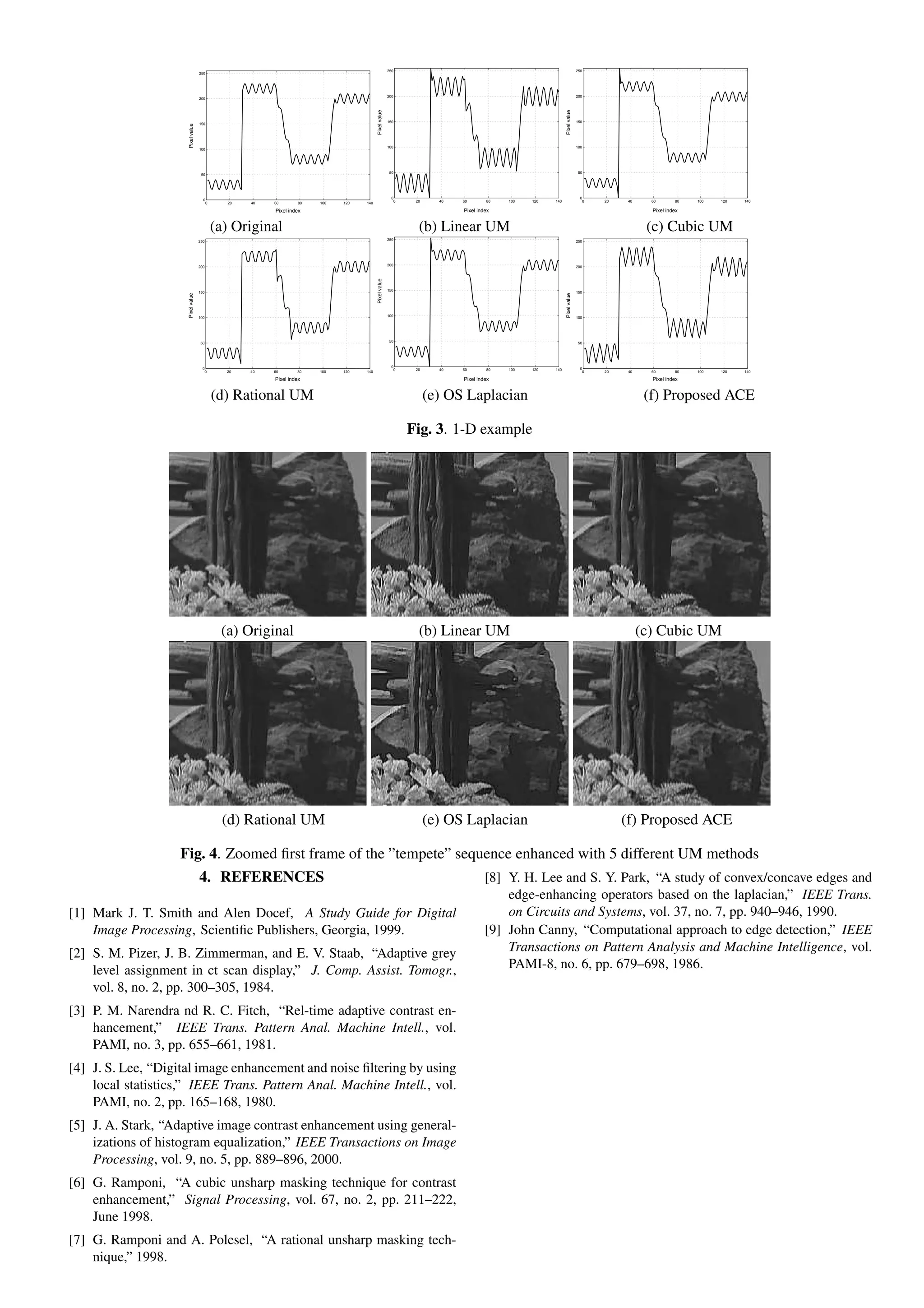 250                                                                  250
                                   250




                                                                                                       200                                                                  200
                                   200




                                                                                         Pixel value




                                                                                                                                                              Pixel value
                                                                                                       150                                                                  150
                                   150




                     Pixel value
                                                                                                       100                                                                  100
                                   100




                                                                                                        50                                                                   50
                                    50




                                                                                                         0                                                                    0
                                     0                                                                       0    20     40   60       80   100   120   140                       0   20   40     60       80   100   120   140
                                         0     20   40   60       80   100   120   140

                                                         Pixel index                                                          Pixel index                                                         Pixel index


                                             (a) Original                                                          (b) Linear UM                                                                 (c) Cubic UM
                                   250                                                                 250                                                                  250




                                   200                                                                 200                                                                  200




                                                                                         Pixel value
                                   150                                                                 150                                                                  150
                     Pixel value




                                                                                                                                                              Pixel value
                                   100                                                                 100                                                                  100




                                    50                                                                  50                                                                   50




                                     0                                                                   0                                                                    0
                                         0     20   40   60       80   100   120   140                       0    20     40   60       80   100   120   140                       0   20   40     60       80   100   120   140

                                                         Pixel index                                                          Pixel index                                                         Pixel index


                                             (d) Rational UM                                                           (e) OS Laplacian                                                          (f) Proposed ACE

                                                                                                                 Fig. 3. 1-D example




                                              (a) Original                                                         (b) Linear UM                                                                (c) Cubic UM




                                              (d) Rational UM                                                          (e) OS Laplacian                                                    (f) Proposed ACE

                    Fig. 4. Zoomed ﬁrst frame of the ”tempete” sequence enhanced with 5 different UM methods
                                   4. REFERENCES                                                                                       [8] Y. H. Lee and S. Y. Park, “A study of convex/concave edges and
                                                                                                                                           edge-enhancing operators based on the laplacian,” IEEE Trans.
[1] Mark J. T. Smith and Alen Docef, A Study Guide for Digital                                                                             on Circuits and Systems, vol. 37, no. 7, pp. 940–946, 1990.
    Image Processing, Scientiﬁc Publishers, Georgia, 1999.                                                                             [9] John Canny, “Computational approach to edge detection,” IEEE
[2] S. M. Pizer, J. B. Zimmerman, and E. V. Staab, “Adaptive grey                                                                          Transactions on Pattern Analysis and Machine Intelligence, vol.
    level assignment in ct scan display,” J. Comp. Assist. Tomogr.,                                                                        PAMI-8, no. 6, pp. 679–698, 1986.
    vol. 8, no. 2, pp. 300–305, 1984.
[3] P. M. Narendra nd R. C. Fitch, “Rel-time adaptive contrast en-
    hancement,” IEEE Trans. Pattern Anal. Machine Intell., vol.
    PAMI, no. 3, pp. 655–661, 1981.
[4] J. S. Lee, “Digital image enhancement and noise ﬁltering by using
    local statistics,” IEEE Trans. Pattern Anal. Machine Intell., vol.
    PAMI, no. 2, pp. 165–168, 1980.
[5] J. A. Stark, “Adaptive image contrast enhancement using general-
    izations of histogram equalization,” IEEE Transactions on Image
    Processing, vol. 9, no. 5, pp. 889–896, 2000.
[6] G. Ramponi, “A cubic unsharp masking technique for contrast
    enhancement,” Signal Processing, vol. 67, no. 2, pp. 211–222,
    June 1998.
[7] G. Ramponi and A. Polesel, “A rational unsharp masking tech-
    nique,” 1998.
 