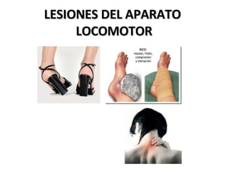 LESIONES DEL APARATO  LOCOMOTOR 
