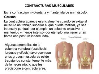 Es la contracción involuntaria y mantenida de un músculo. Causas La contractura aparece esencialmente cuando se exige al músculo un trabajo superior al que puede realizar, ya sea intenso y puntual -por ejemplo, un esfuerzo excesivo- o mantenido y menos intenso -por ejemplo, mantener unas horas una postura inadecuada-.  CONTRACTURAS MUSCULARES Algunas anomalías de la columna vertebral (escoliosis, lordosis y cifosis) favorecen que unos grupos musculares estén trabajando constantemente más de lo necesario, lo que les predispone a contracturarse. 