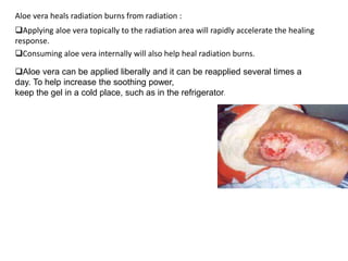 Aloe vera heals radiation burns from radiation :
Applying aloe vera topically to the radiation area will rapidly accelerate the healing
response.
Consuming aloe vera internally will also help heal radiation burns.
Aloe vera can be applied liberally and it can be reapplied several times a
day. To help increase the soothing power,
keep the gel in a cold place, such as in the refrigerator.
 