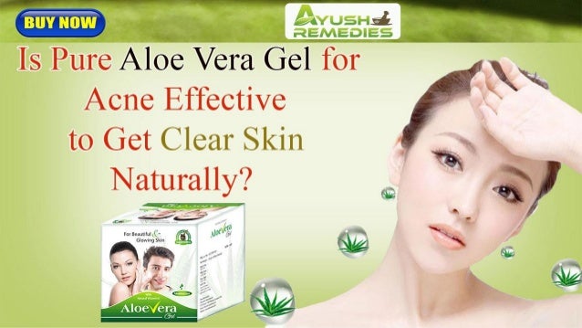 Is Pure Aloe Vera Gel For Acne Effective To Get Clear Skin Naturally
