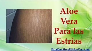 Aloe
  Vera
 Para las
 Estrías
ParaQueSirveElAloeVera.com
 