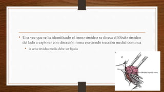 • Una vez que se ha identificado el istmo tiroideo se diseca el lóbulo tiroideo
del lado a explorar con disección roma ejerciendo tracción medial continua
• la vena tiroidea media debe ser ligada
 