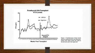 Aloinjerto de paratiroides