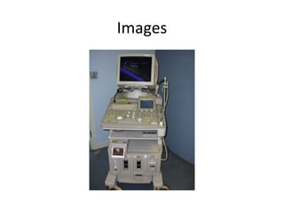 Prosound 5000 Aloka prosound ssd 5000 ultrasound system | PPT