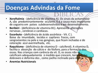 Doenças Advindas da Fome
• Xeroftalmia - (deficiência de vitamina A). Os sinais da avitaminose
  A, são predominantemente oculares. E é a causa mais importante
  de cegueira em países subdesenvolvidos e em desenvolvimento.
• Beribéri - (deficiência de vitamina B1). Apresenta alterações
  nervosas , cerebrais e cardíacas.
• Escorbuto - (deficiência de ácido ascórbico - Vit. C ).
  Baixa da imunidade, tecidos e capilares fracos, com
  sangramentos na pele e nas gengivas, que ficam inchadas e de
  coloração azul-avermelhada, etc.
• Raquitismo - (deficiência de vitamina D - calciferol). A vitamina D,
  facilita a absorção do cálcio e do fósforo, para a formação dos
  ossos. Nas crianças com carência da vit. D, os ossos não se
  calcificam adequadamente à medida que crescem, tornando-se
  dobraveis e deforma dos , como joelho inclinado para dentro.
• Anemias Nutricionais
 