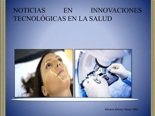 NOTICIAS EN INNOVACIONES
TECNOLÓGICAS EN LA SALUD
Adriana Alonso Otavo 1003
 