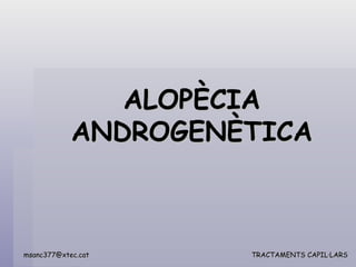 Alopècia androgenètica