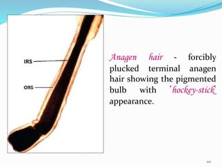 Anagen hair - forcibly
plucked terminal anagen
hair showing the pigmented
bulb with 'hockey-stick'
appearance.
101
 