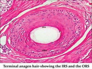 Terminal anagen hair-showing the IRS and the ORS109
 