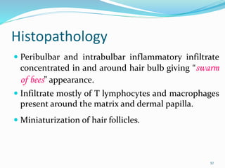 Histopathology
 Peribulbar and intrabulbar inflammatory infiltrate
concentrated in and around hair bulb giving “swarm
of bees” appearance.
 Infiltrate mostly of T lymphocytes and macrophages
present around the matrix and dermal papilla.
 Miniaturization of hair follicles.
57
 