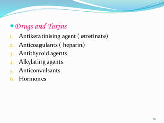 Drugs and Toxins
1. Antikeratinising agent ( etretinate)
2. Anticoagulants ( heparin)
3. Antithyroid agents
4. Alkylating agents
5. Anticonvulsants
6. Hormones
66
 