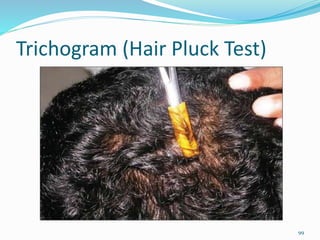 Trichogram (Hair Pluck Test)
99
 