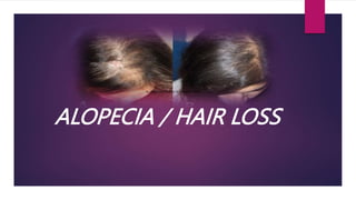 ALOPECIA / HAIR LOSS
This Photo by Unknown Author is licensed under
CC BY
 