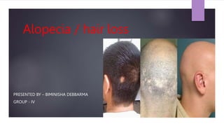 Alopecia / hair loss
PRESENTED BY – BIMINISHA DEBBARMA
GROUP - IV
 