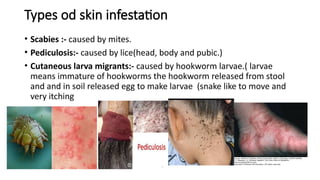 Infested Body Comprehensive Overview of Infestation Dermatitis and Related Skin ...