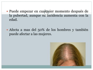  Puede empezar en cualquier momento después de 
la pubertad, aunque su incidencia aumenta con la 
edad. 
 Afecta a mas del 50% de los hombres y también 
puede afectar a las mujeres. 
 