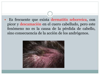  Es frecuente que exista dermatitis seborreica, con 
picor y descamación en el cuero cabelludo, pero este 
fenómeno no es la causa de la pérdida de cabello, 
sino consecuencia de la acción de los andrógenos. 
 