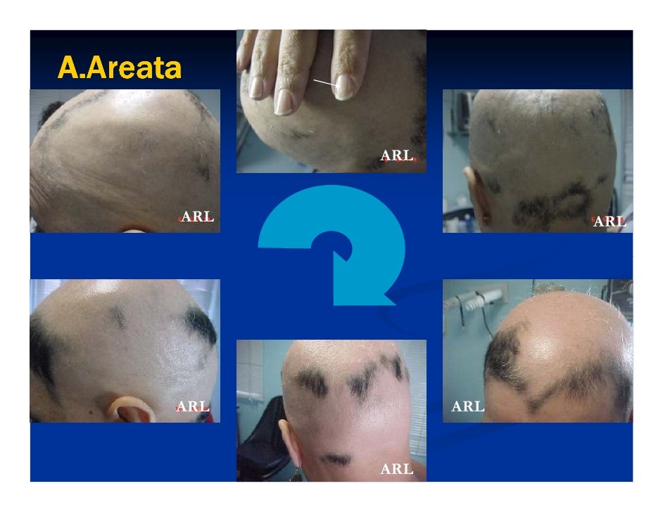 Planeta organica secrets of kamchatka mineral la máscara para el crecimiento de los cabello