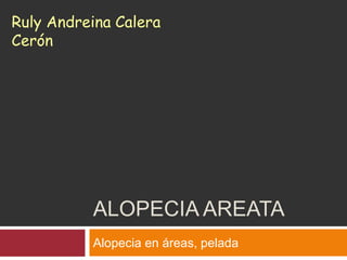 ALOPECIA AREATA
Alopecia en áreas, pelada
Ruly Andreina Calera
Cerón
 