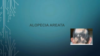 ALOPECIA AREATA
 