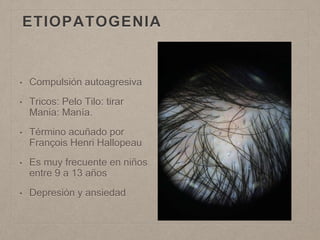 ETIOPATOGENIA 
• Compulsión autoagresiva 
• Tricos: Pelo Tilo: tirar 
Mania: Manía. 
• Término acuñado por 
François Henri Hallopeau 
• Es muy frecuente en niños 
entre 9 a 13 años 
• Depresión y ansiedad 
 