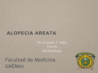 ALOPECIA AREATA 
Dr. Gerardo V. Solís 
Arreola 
Dermatólogo 
Facultad de Medicina 
UAEMex 
 