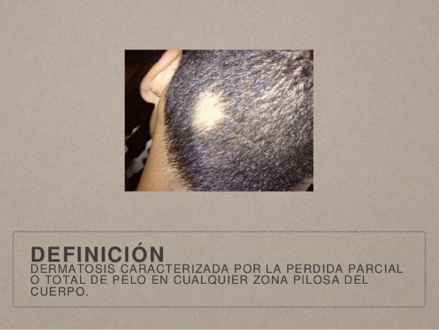 El aceite de ricino para los cabellos para sekuschihsya