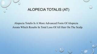 ALOPECIA TOTALIS (AT)
Alopecia Totalis Is A More Advanced Form Of Alopecia
Areata Which Results In Total Loss Of All Hair On The Scalp.
 
