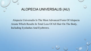 ALOPECIA UNIVERSALIS (AU)
Alopecia Universalis Is The Most Advanced Form Of Alopecia
Areata Which Results In Total Loss Of All Hair On The Body,
Including Eyelashes And Eyebrows.
 