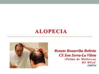 ALOPECIA
Renato Bonarriba Beltrán
CS Son Serra-La Vileta
(Palm a de Mal lorca)
R4 MFyC
15/07/13
 