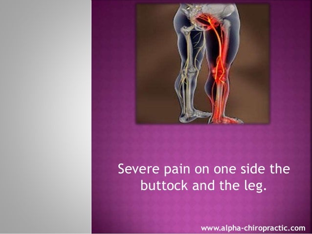 Low Back Pain Symptoms