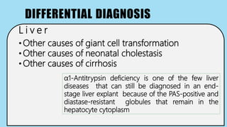 DIFFERENTIAL DIAGNOSIS
L i v e r
• Other causes of giant cell transformation
• Other causes of neonatal cholestasis
• Other causes of cirrhosis
α1-Antitrypsin deficiency is one of the few liver
diseases that can still be diagnosed in an end-
stage liver explant because of the PAS-positive and
diastase-resistant globules that remain in the
hepatocyte cytoplasm
 