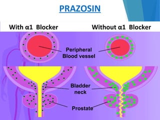 PRAZOSIN
18
Peripheral
Blood vessel
Bladder
neck
Prostate
With α1 Blocker Without α1 Blocker
 