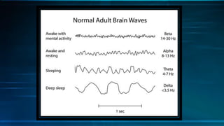 Alpha state of mind | PDF