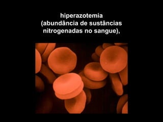 hiperazotemia
(abundância de sustâncias
 nitrogenadas no sangue),
 